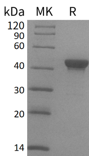 Recombinant Human CTH
