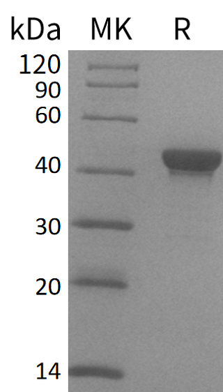 Recombinant Human CTH