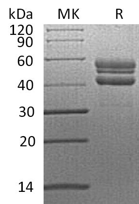 Recombinant Human RELT (C-Fc)