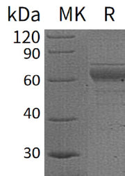 Recombinant Human IL-20RB (C-Fc)