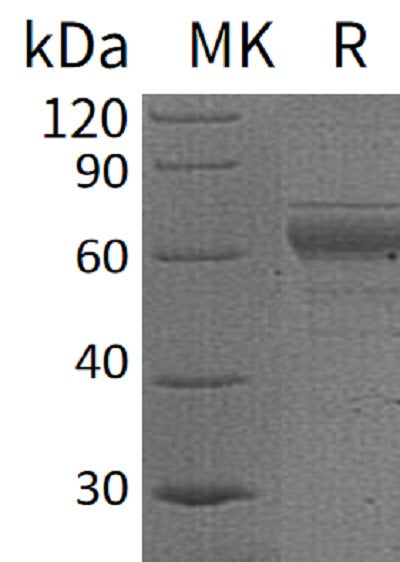 Recombinant Human IL-20RB (C-Fc)
