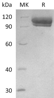 Recombinant NDV HN