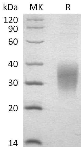 Recombinant Mouse IL-9 (C-6His)