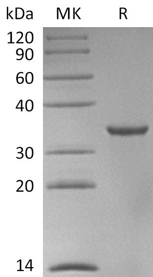 Recombinant Human STUB1