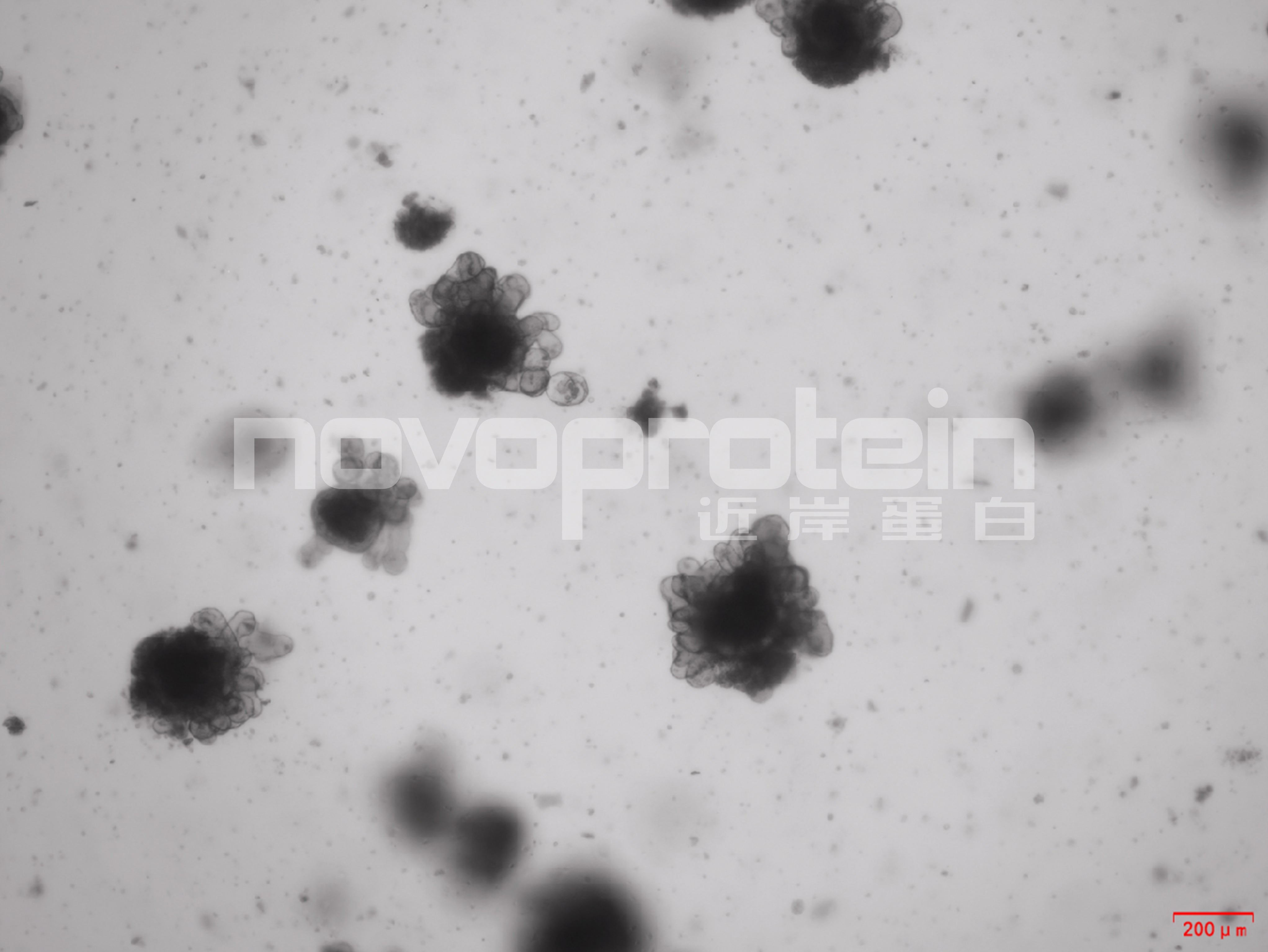 Recombinant Mouse Noggin (C-6His)