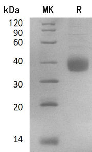 Recombinant Human NACHRA5 (C-6His)