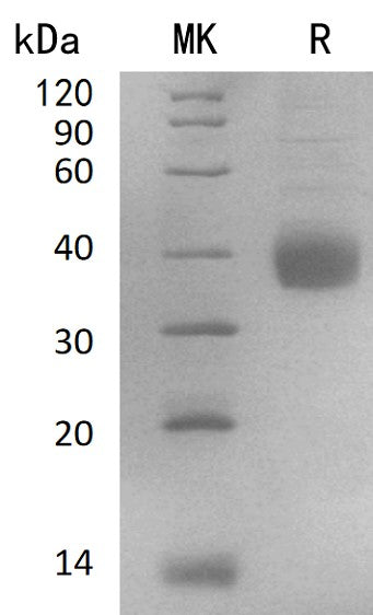 Recombinant Human NACHRA5 (C-6His)