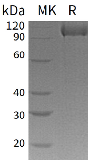 Recombinant Human Complement Factor MASP3 (C-6His)