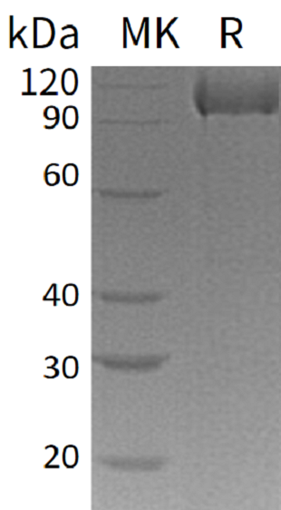 Recombinant Human Complement Factor MASP3 (C-6His)
