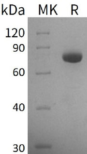 Recombinant Human GALNT3 (C-6His)