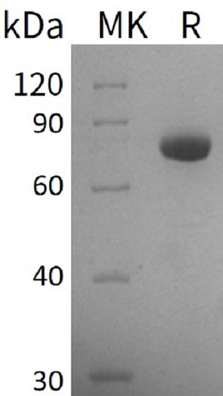 Recombinant Human GALNT3 (C-6His)