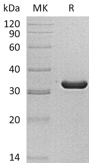 Recombinant Human SULT1C2 (N-6His)