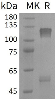 Recombinant Human IGF-I R (C-6His)