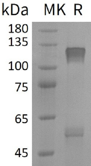 Recombinant Human IGF-I R (C-6His)