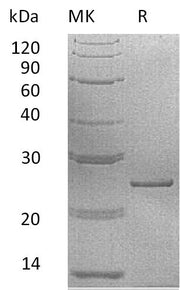 Recombinant Human PRL