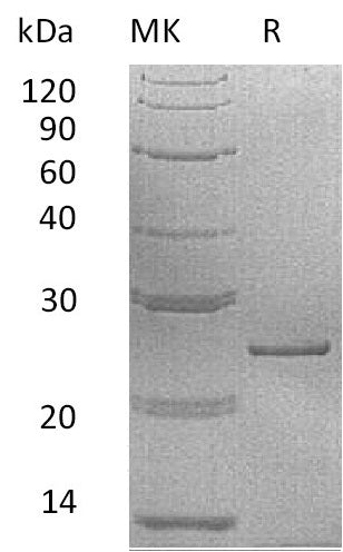 Recombinant Human PRL
