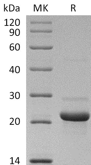 Recombinant Human C8 gamma (N-6His)