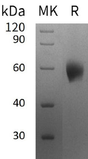 Recombinant Human IL-1RAcP (Q9NPH3-2, C-6His)