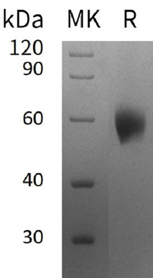 Recombinant Human IL-1RAcP (Q9NPH3-2, C-6His)