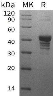 Recombinant Human UQCRH (N-GST)
