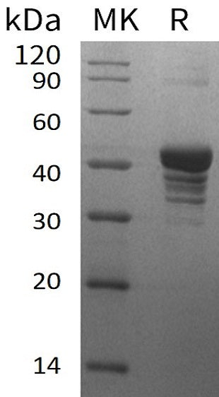 Recombinant Human UQCRH (N-GST)