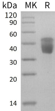 Recombinant Human CLEC10A (C-6His)
