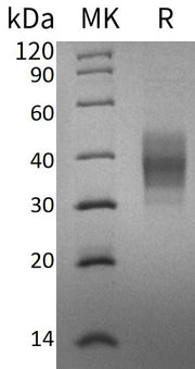 Recombinant Human ASGPR1 (C-6His)
