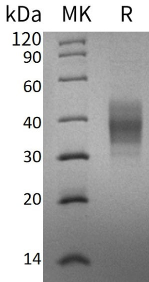 Recombinant Human ASGPR1 (C-6His)