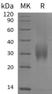 Recombinant Human ACVR2B (C-6His)