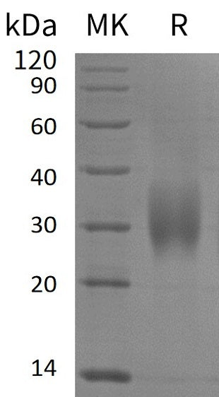 Recombinant Human ACVR2B (C-6His)