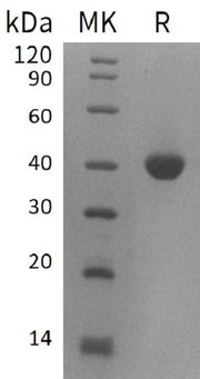 Recombinant Human B4GALT4 (C-6His)