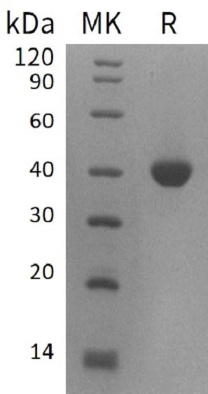 Recombinant Human B4GALT4 (C-6His)