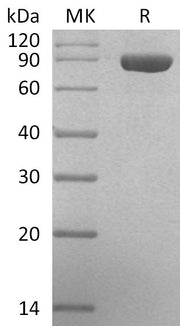 Recombinant Human beta-Glucuronidase (C-6His)
