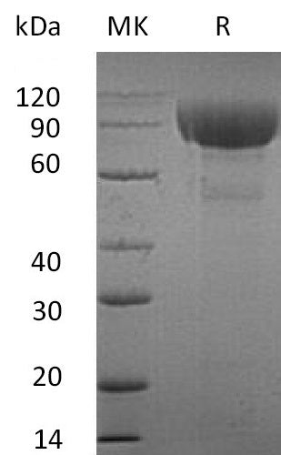 Recombinant Human IL-1RL2 (C-Fc)