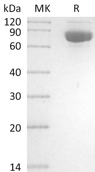 Recombinant NDV (strain NA-1) HN