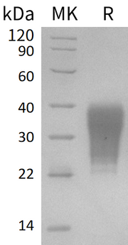 Recombinant Human FAS (C-6His)