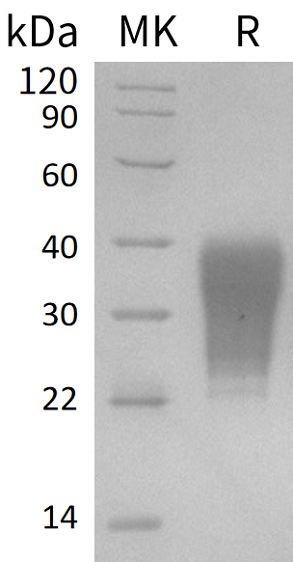 Recombinant Human FAS (C-6His)
