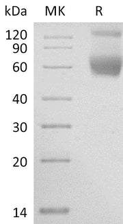 Recombinant Human Serpin A4 (C-6His)