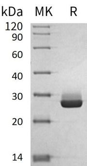 Recombinant Human DTYMK (C-6His)