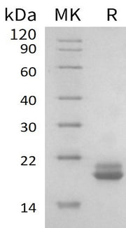Recombinant Human EIF4EBP2 (N-6His)