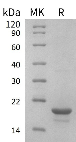 Recombinant Human EIF4EBP1 (N-6His)