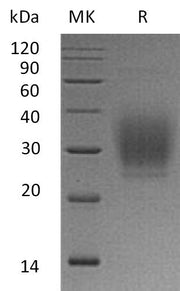 Recombinant Human PTH1R (C-6His)