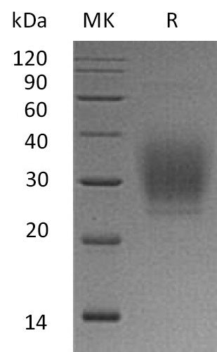 Recombinant Human PTH1R (C-6His)