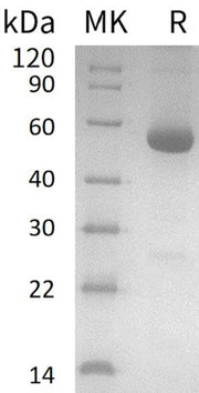 Recombinant Human ODC1 (C-6His, N-T7 tag)