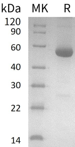 Recombinant Human ODC1 (C-6His, N-T7 tag)