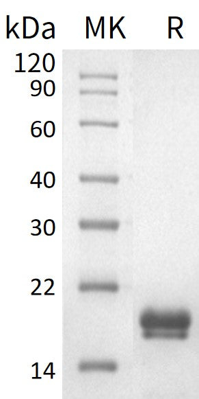Recombinant Human REG1A (C-6His)